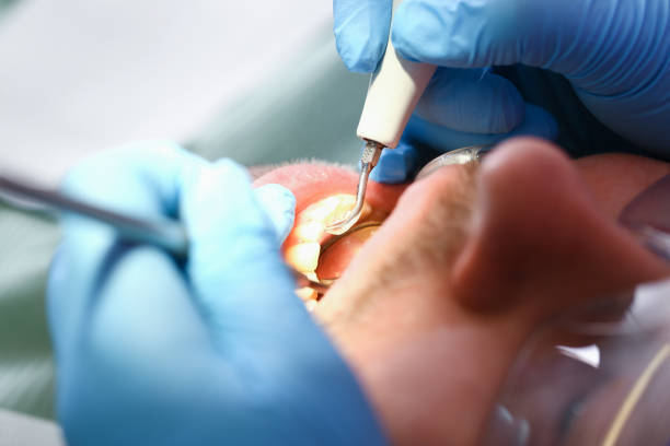 Best Emergency Dental Care for Abscessed Tooth in Pleasant Hills, OH