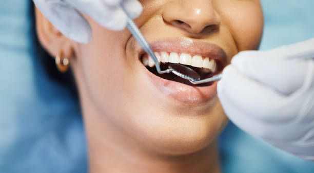 Best Emergency Dentist for Lost Fillings or Crowns in Pleasant Hills, OH